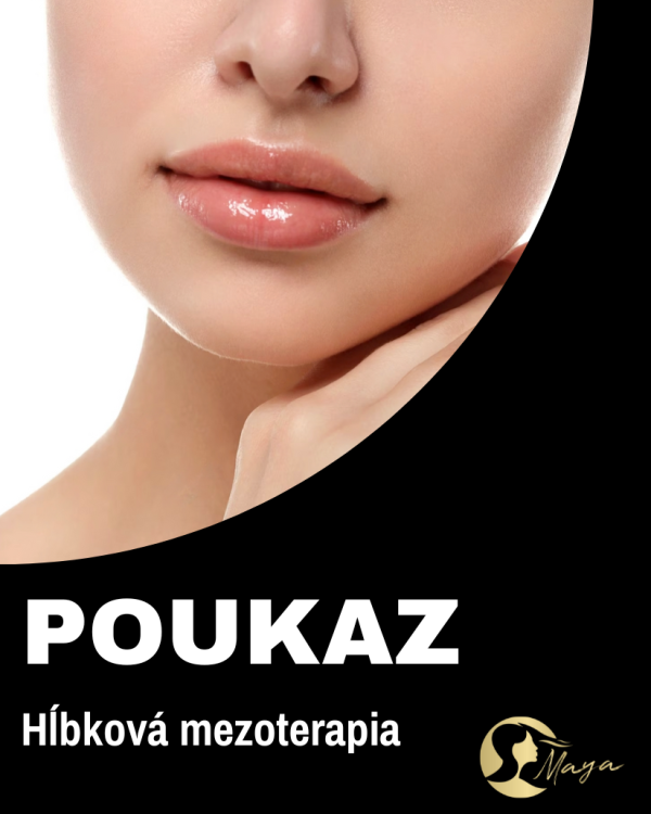 Mezoterapia radiesse